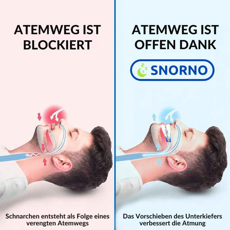 Proti chrápaniu náustok – Nastaviteľný spánkový náustok s ergonomickým tvarom