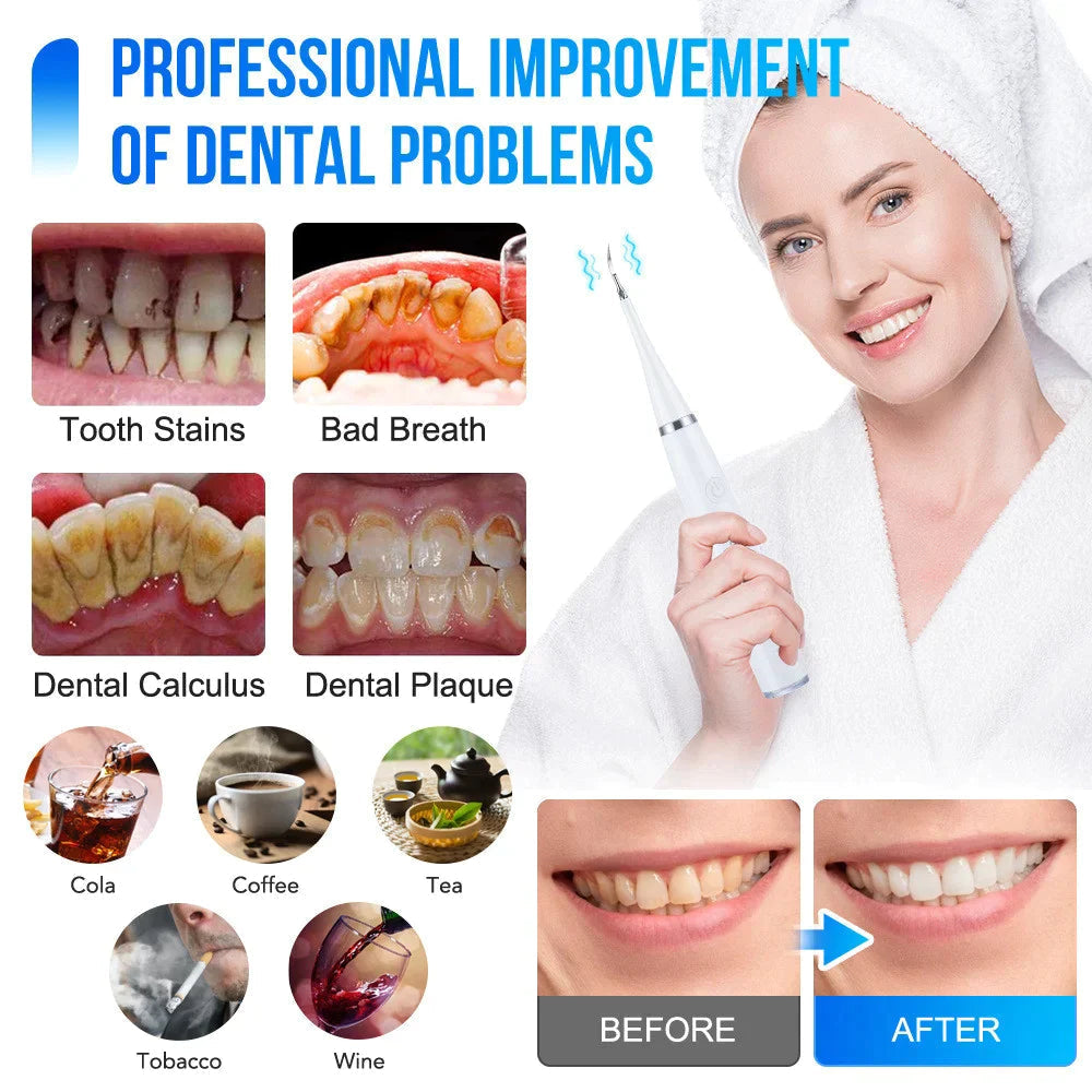 ToothCleaner – Pulitore dentale a ultrasuoni per una cura dentale approfondita